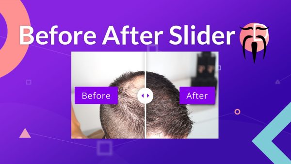 Divi Sensei Before After Slider - divi编辑器图像前后对比插件